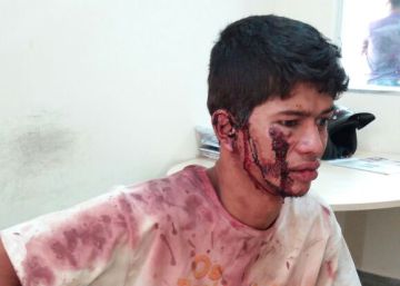 Fazendeiros acusam seguranças da Vale de agressão no Pará