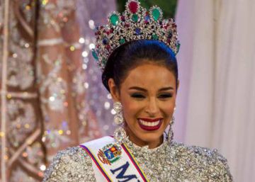 “Farei a cirurgia plástica que for necessária para ser Miss Venezuela”