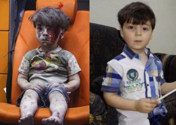 O menino sírio Omran, quase um ano depois do bombardeio de Aleppo O menino sírio Omran, quase um ano depois do bombardeio de Aleppo