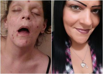 Ex-viciada publica fotos de seu pior momento: “A heroína destruiu minha vida”