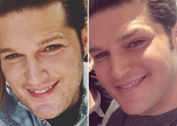 Doutor, quero me parecer com minha selfie