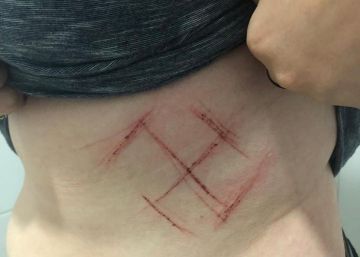 Polícia investiga denúncia de agressão com canivete a jovem com camisa “ele não”