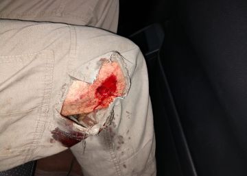 Fotógrafo é atingido por bala de borracha em ato contra aumento de tarifa em São Paulo