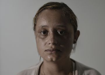 Paloma da Cunha, de 22 anos, foi arrastada pela enxurrada de lama após o colapso da barragem em Brumadinho, mas conseguiu ser salva.