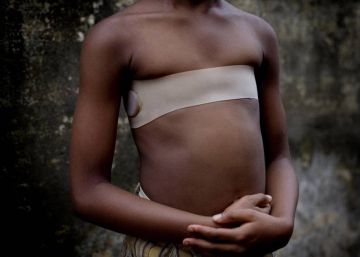 A tortura silenciosa para que as meninas africanas não se tornem mulheres