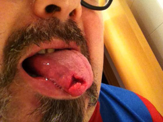 Imatge de l'agressió a Francesc Abad, penjada per ell a Twitter.