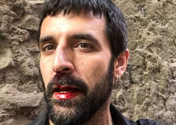El fotoperiodista Jordi Borràs denuncia una agressió al centre de Barcelona