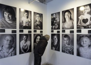 Retrats solidaris per fer visibles les malalties minoritàries