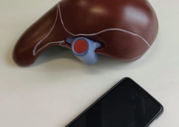 Una aplicació permetrà precisar els fetges que són útils per al transplantament