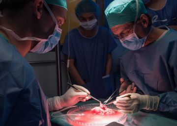 El Clínic, primer hospital europeu a fer 100 trasplantaments de ronyó robòtics