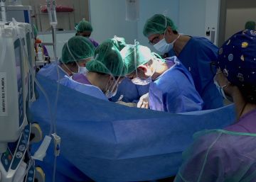 Primer trasplantament creuat a Espanya de ronyó pediàtric de grup sanguini incompatible