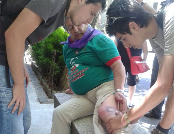 Un minero jubilado de Gijón muestra sus heridas.