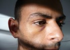 Dos inmigrantes denuncian agresiones policiales en Zapadores Dos inmigrantes denuncian agresiones policiales en Zapadores