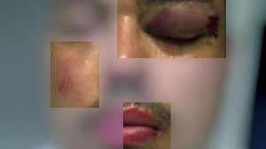 Imagen difundida en Twitter por el joven que recibió una paliza.