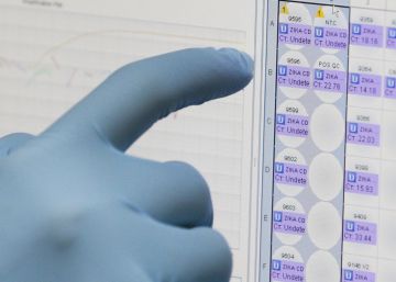 Salut va detectar la microcefàlia al fetus a les 20 setmanes d’embaràs