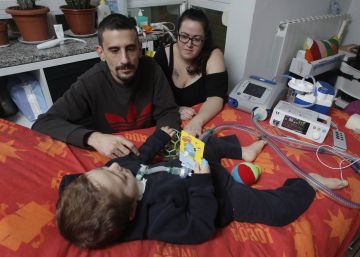 Pequeñas victorias para el niño ‘electrodependiente’