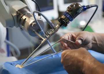 13.000 euros por equivocarse de pie en una operación quirúrgica