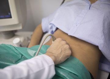 Ofensiva para frenar el retraso diagnóstico de la endometriosis