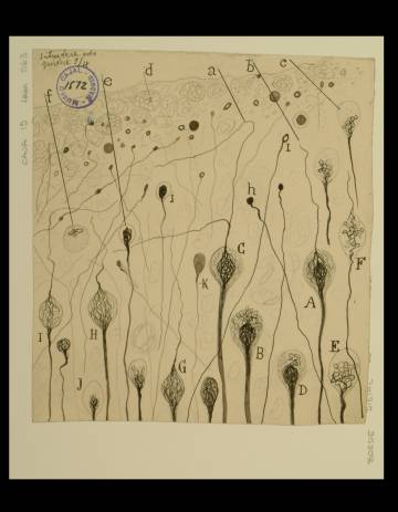 Una ferida cerebral de gos, de Ramón y Cajal.