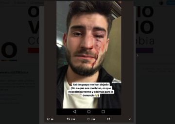 Dos detinguts per una presumpta agressió homòfoba al metro de Barcelona