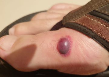Detectan chinches en un módulo de la cárcel de Valdemoro