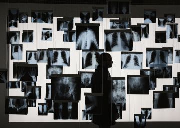 Radiografia de la sanitat catalana