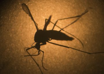 Una embarassada amb zika dóna a llum un nadó sense malformacions