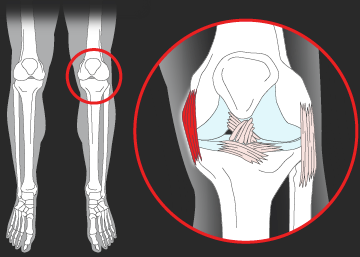 Cristiano Ronaldo sofre entorse de ligamento