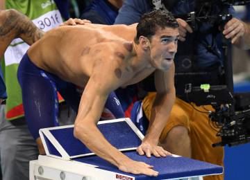 Phelps, con las marcas circulares en su piel.