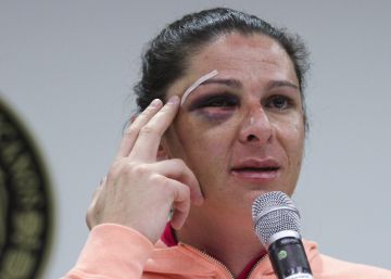 Liberado el agresor de la senadora Ana Gabriela Guevara