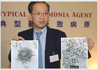 Los investigadores dan con una prueba que diagnostica la neumonía asiática Los investigadores dan con una prueba que diagnostica la neumonía asiática