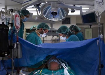 La justicia condena a indemnizar a la mujer del paciente que iba a ser circuncidado y salió con una vasectomía