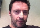 Hugh Jackman confessa que tem câncer de pele