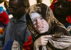 Historia de dos albinos:
Salif Keita y la niña Rabiatou