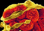Una nueva técnica amplía el arsenal contra las superbacterias