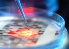 Un test de ADN diagnostica un 30% de la discapacidad mental oculta