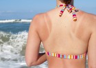 Will sun-burnt skin go brown?