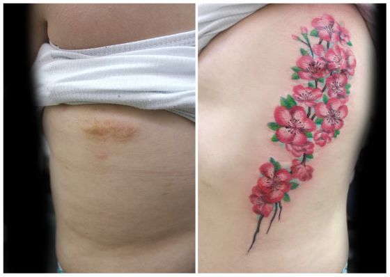 La tatuadora que cubre las marcas de violencia doméstica La tatuadora que cubre las marcas de violencia doméstica