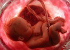 Primer ensayo clínico para tratar a bebés con células madre en el útero