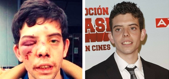 Javier Bodalo, El Rana en 'Cuentame', a quien le propinaron una paliza el 20 de noviembre de 2015