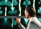 Un test genómico del tumor de mama predice el resultado del tratamiento