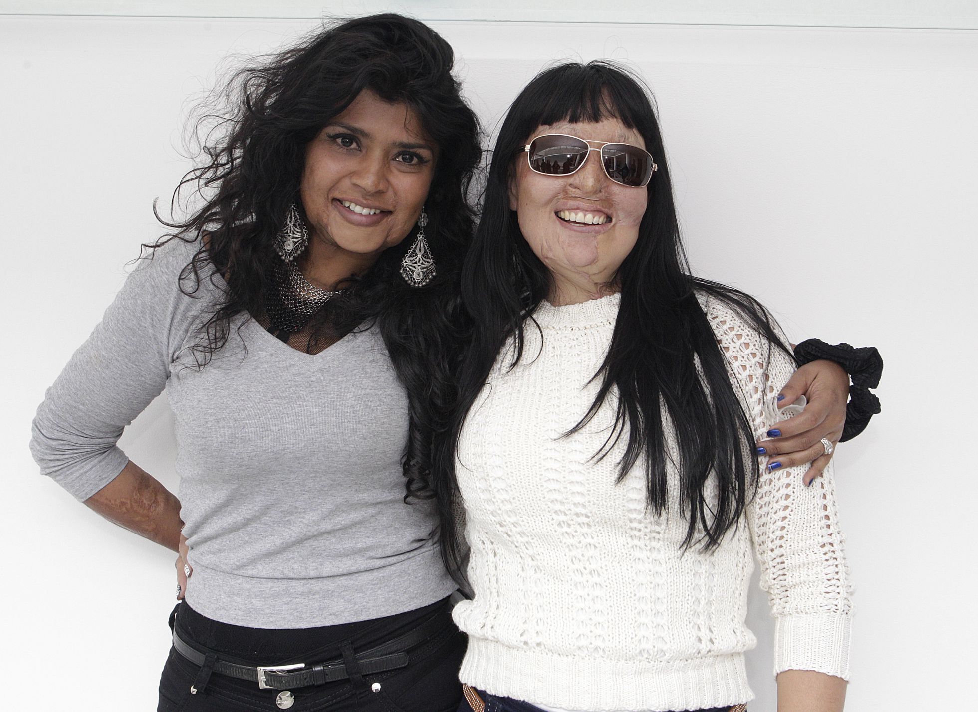 Gina Potes con Patricia, su gran amiga cuya hija adolescente se suicidó al verla desfigurada. Imagen de su archivo personal. Gina Potes con Patricia, su gran amiga cuya hija adolescente se suicidó al verla desfigurada. Imagen de su archivo personal.