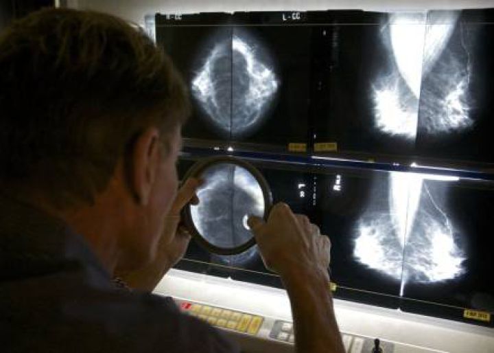 Las guías sobre cáncer infravaloran los riesgos de las pruebas para detectarlo Las guías sobre cáncer infravaloran los riesgos de las pruebas para detectarlo