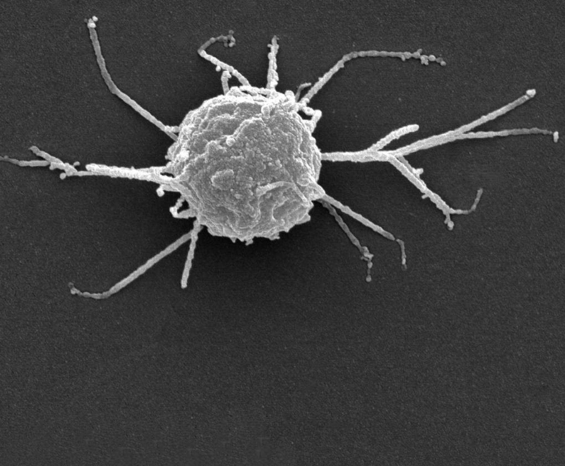 Ameba de la especie 'Capsaspora owczarzaki'. Ameba de la especie 'Capsaspora owczarzaki'.