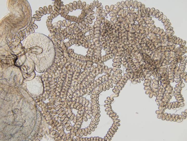 Receptáculo del esperma de una mosca de la fruta, de unos ocho centímetros. El órgano ha coevolucionado con el del tamaño de los espermatozoides Receptáculo del esperma de una mosca de la fruta, de unos ocho centímetros. El órgano ha coevolucionado con el del tamaño de los espermatozoides