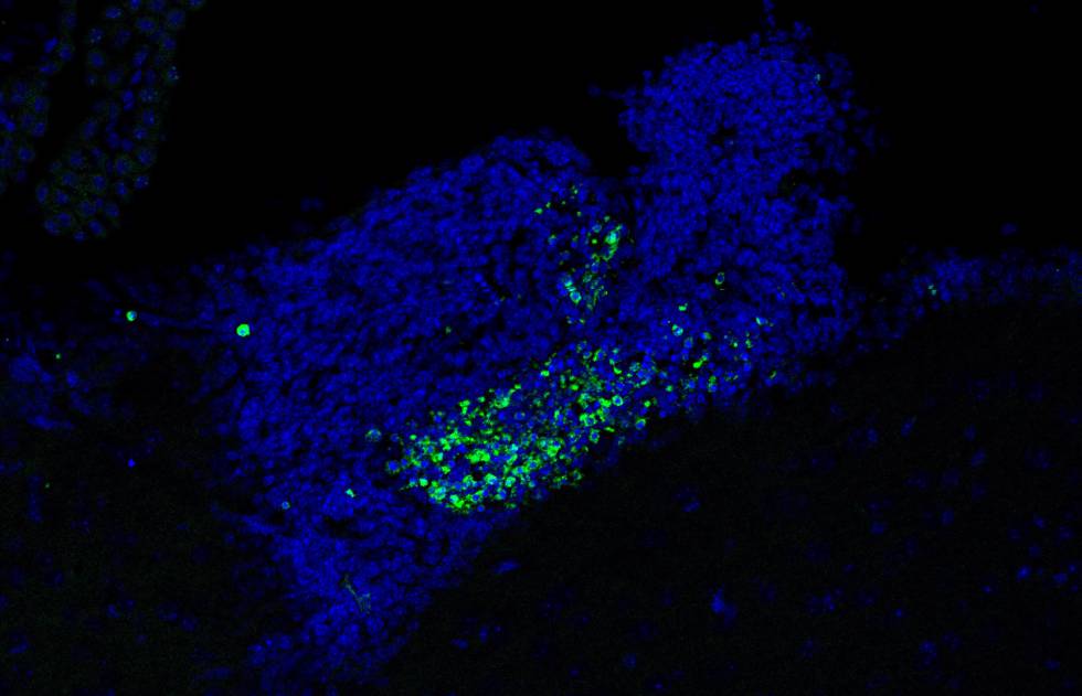 Acumulación de células muertas (puntos verdes) en zonas de generazión de neuronas