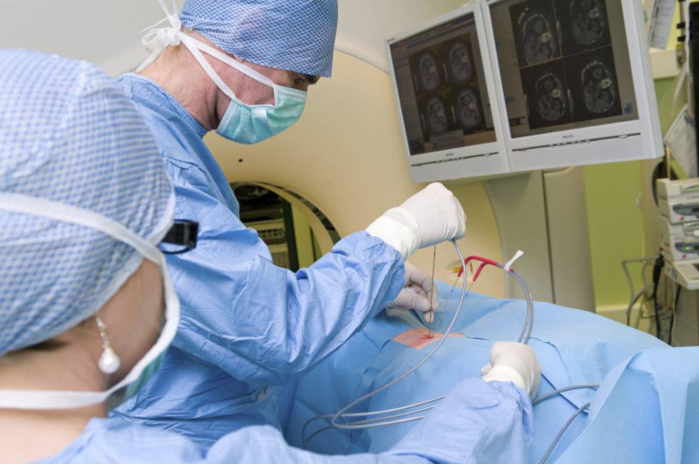 Ahora, la cirugía es el mejor tratamiento contra el cáncer cuando el tumor se puede extirpar por completo Ahora, la cirugía es el mejor tratamiento contra el cáncer cuando el tumor se puede extirpar por completo