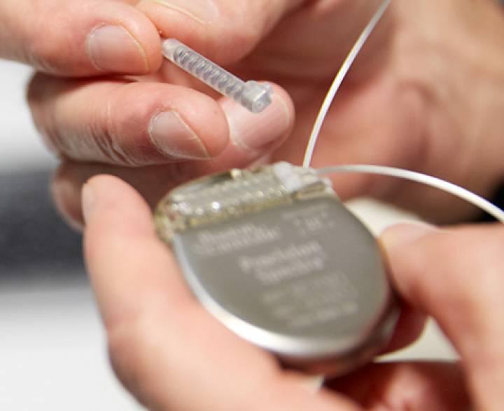 Imagen de la sonda de alta frecuencia y de su batería que implantó Benabid. Imagen de la sonda de alta frecuencia y de su batería que implantó Benabid.