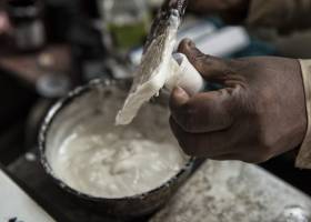 Una unidad de quemados en la trastienda