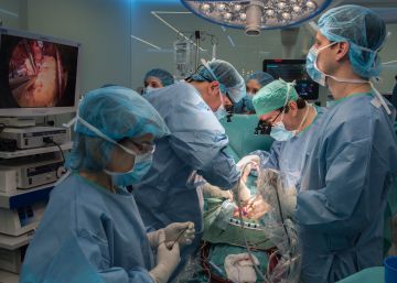 Implanten per primera vegada a Espanya una vàlvula aòrtica humana sense cèl·lules